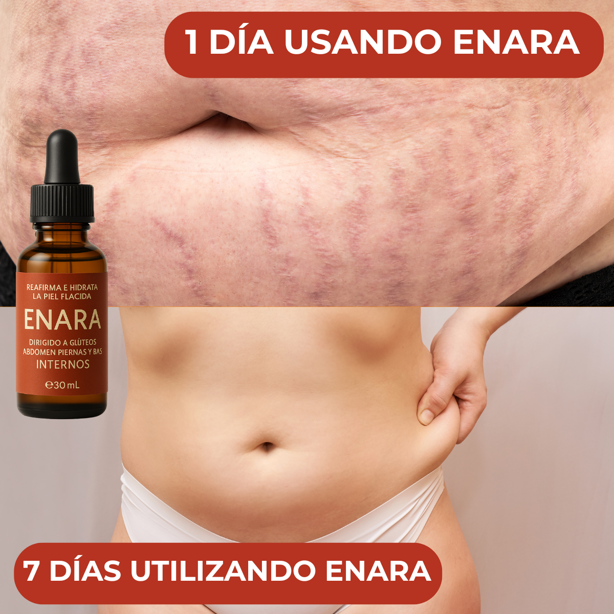 Enara™ – ¡Luce 10 años más joven en solo 2 semanas!